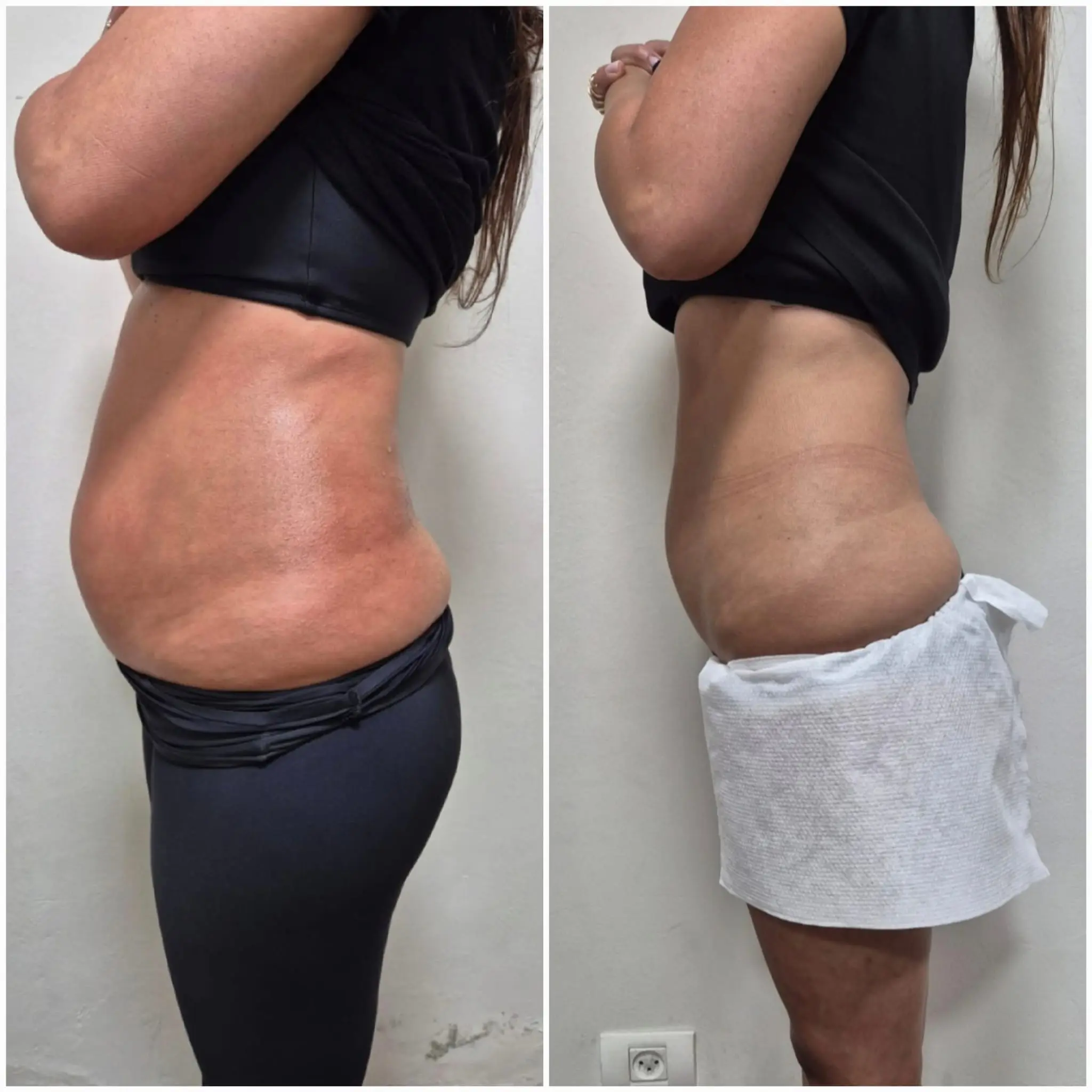 המסות שומן 4