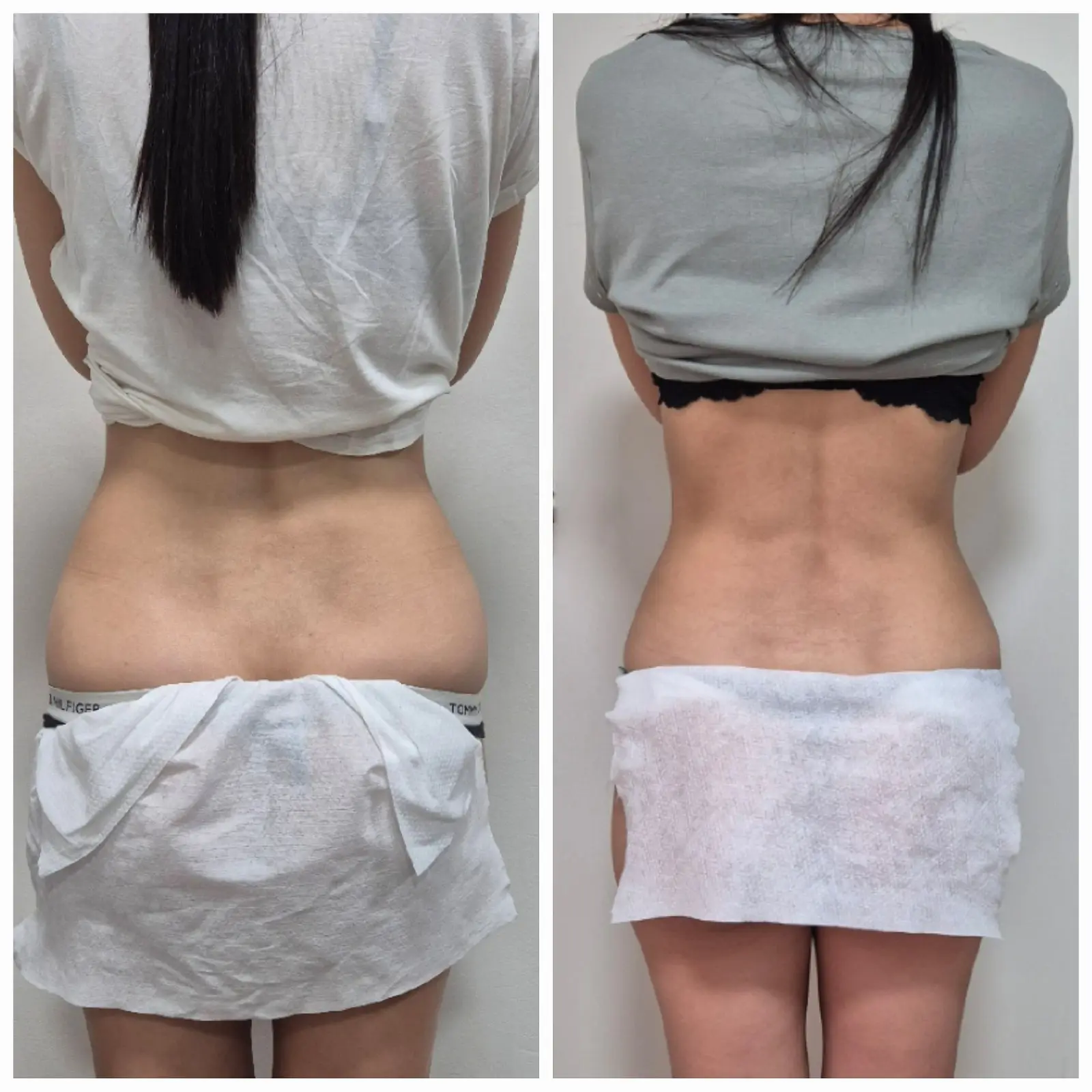 המסות שומן 3