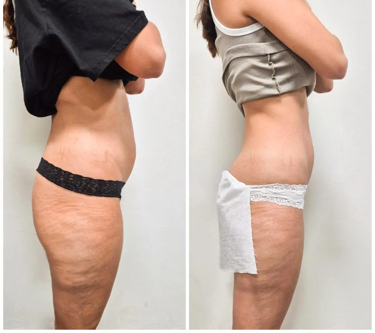 המסות שומן 2