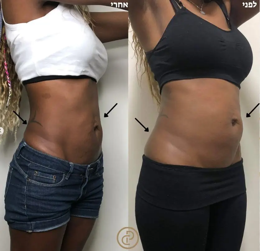 המסות שומן 5