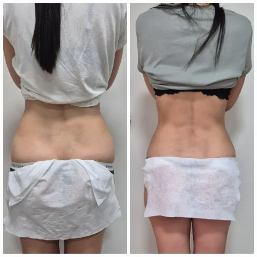 המסות שומן 3