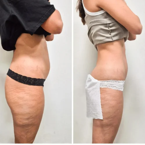 המסות שומן 2