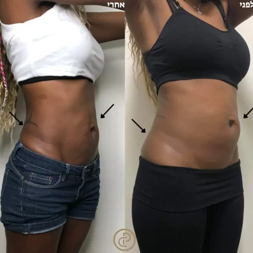 המסות שומן 5